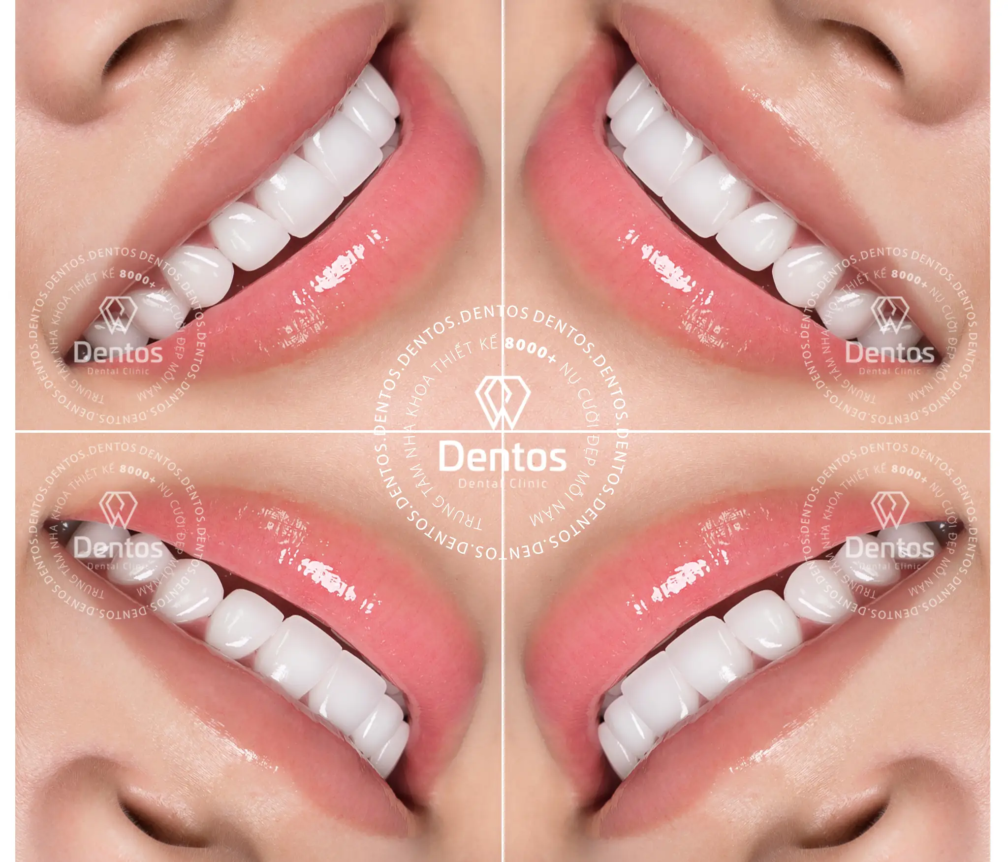 Răng sứ Lava Esthetic trông sống động, có chiều sâu và đẹp tự nhiên như răng thật